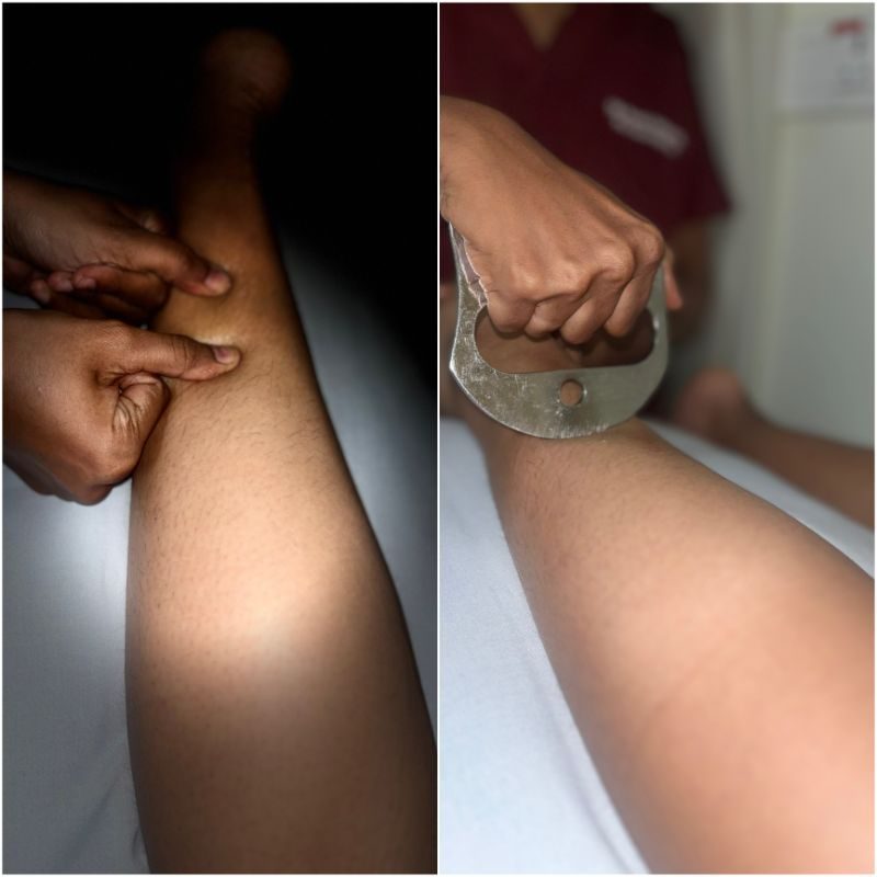 Myofascial Release at Faith Physical Therapy, Thane