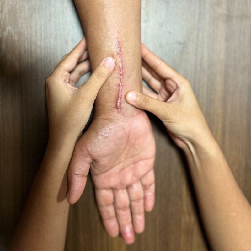Post-Traumatic Rehabilitation at Faith Physical Therapy, Thane